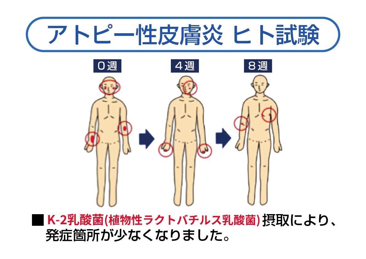 アトピー性皮膚炎　ヒト試験結果