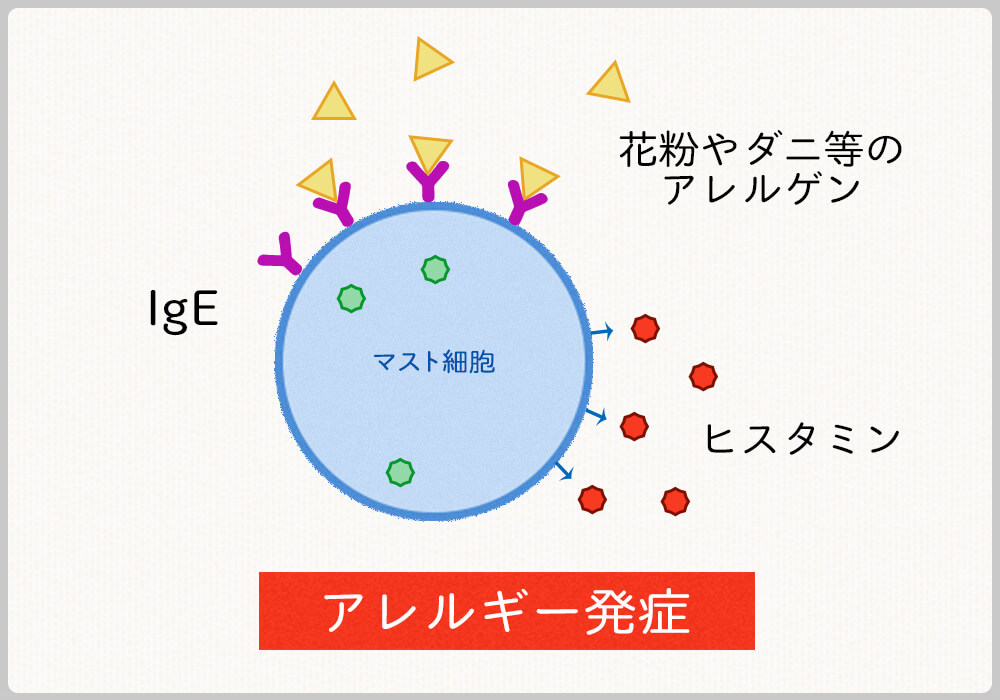 アレルギー発症