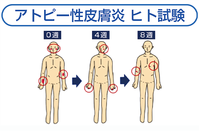 アトピー性皮膚炎 ヒト試験　被験者による評価